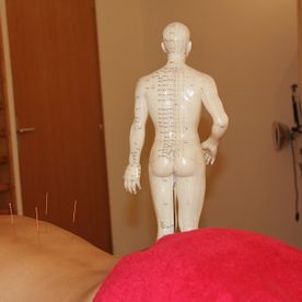 Eaux-Vives Santé - Ricardo Camilo - Acupuncteur et physiothérapeute - Genève - aiguille
